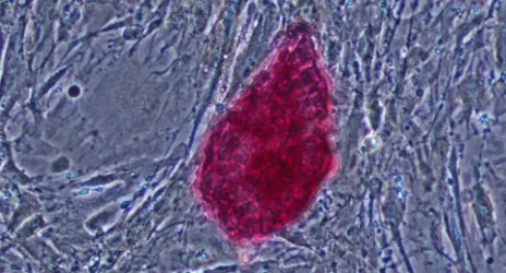 Molecular and Translational Biomedicine Program
