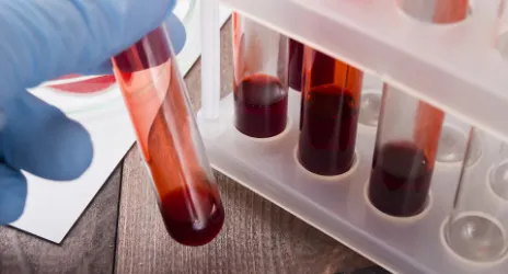 Kan Bankacılığı ve Transfüzyon Tıbbı