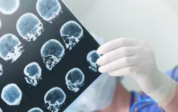 Electroneurophysiology